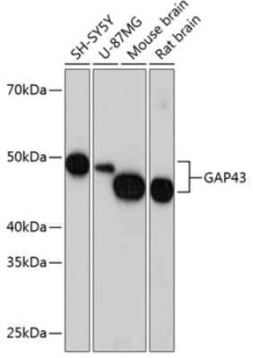 Western Blot: GAP-43 Antibody (8E7C8) [NBP3-15636]