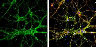 Immunocytochemistry/ Immunofluorescence: GAP-43 Antibody [NBP2-42847]