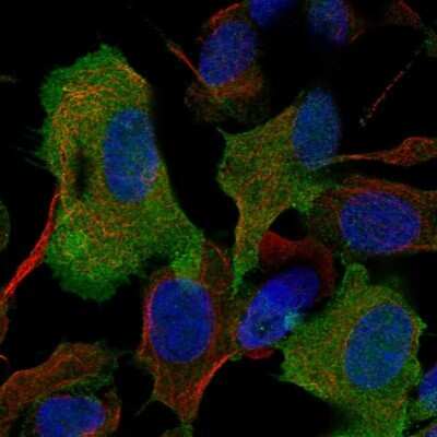 Immunocytochemistry/ Immunofluorescence: GAP-43 Antibody [NBP2-54671]