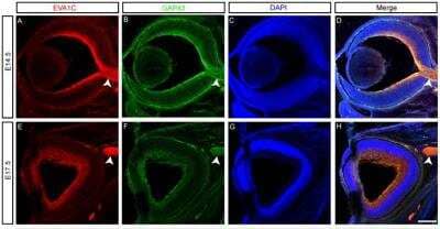 Immunohistochemistry: GAP-43 Antibody [NBP1-41123]