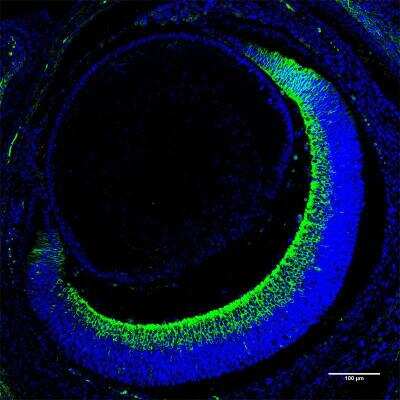 Immunohistochemistry-Paraffin: GAP-43 Antibody [NB300-143]