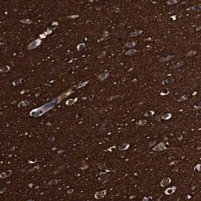 Immunohistochemistry-Paraffin: GAP-43 Antibody [NBP2-54668]