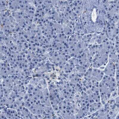 Immunohistochemistry-Paraffin: GAP-43 Antibody [NBP2-54668]