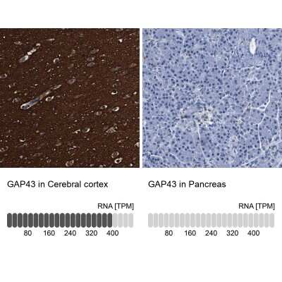 Immunohistochemistry-Paraffin: GAP-43 Antibody [NBP2-54668]