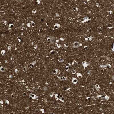 Immunohistochemistry-Paraffin: GAP-43 Antibody [NBP2-54671]