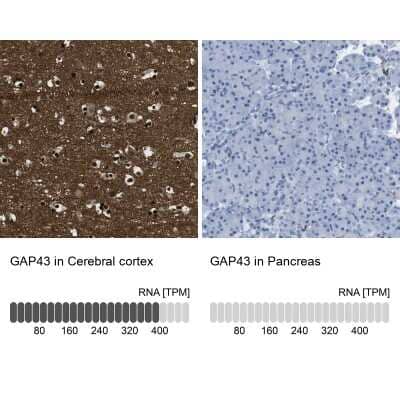Immunohistochemistry-Paraffin: GAP-43 Antibody [NBP2-54671]