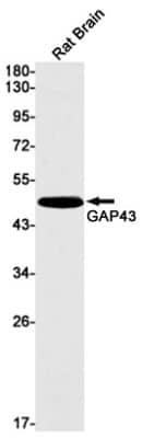 Western Blot: GAP-43 Antibody (S01-4F6) [NBP3-20078]