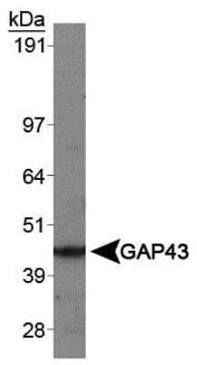 Western Blot: GAP-43 Antibody [NBP1-41123]