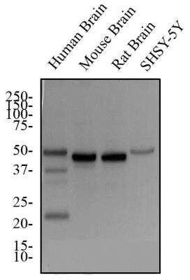 Western Blot: GAP-43 Antibody [NBP1-41123]