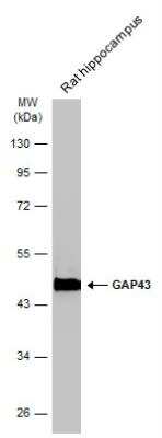Western Blot: GAP-43 Antibody [NBP2-42847]