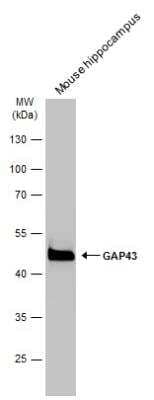 Western Blot: GAP-43 Antibody [NBP2-42847]