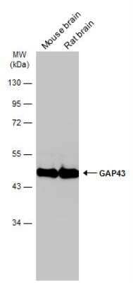 Western Blot: GAP-43 Antibody [NBP2-42847]