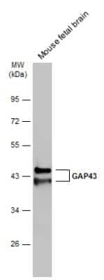 Western Blot: GAP-43 Antibody [NBP2-42847]