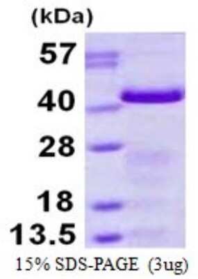 SDS-PAGE: Recombinant Human GAP-43 His Protein [NBP2-53033]