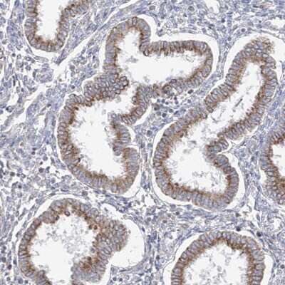 Immunohistochemistry-Paraffin: GAP1m Antibody [NBP1-89794]
