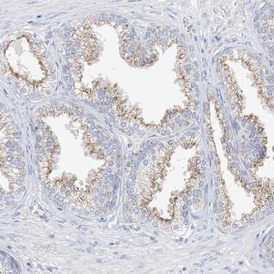 Immunohistochemistry-Paraffin: GAP1m Antibody [NBP1-89794]
