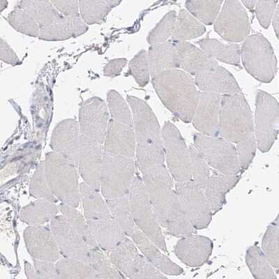 Immunohistochemistry-Paraffin: GAP1m Antibody [NBP1-89794]