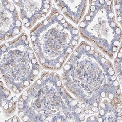 Immunohistochemistry-Paraffin: GAP1m Antibody [NBP1-89794]