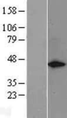 Western Blot: GAP-43 Overexpression Lysate [NBP2-04214]