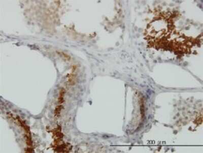 Immunohistochemistry-Paraffin: GAPDH-2 Antibody (2E3-2E10) [H00026330-M01]