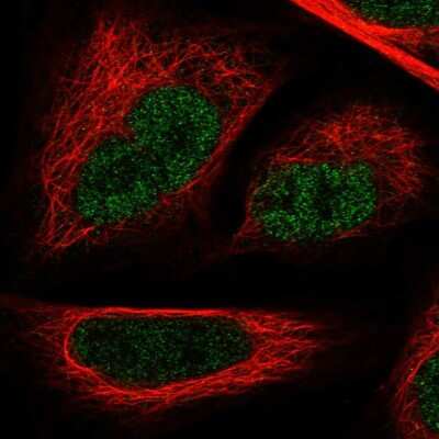 Immunocytochemistry/ Immunofluorescence: GAPDH-2 Antibody [NBP2-31925]