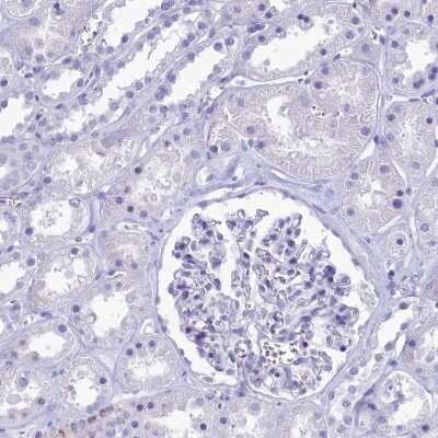 Immunohistochemistry-Paraffin: GAPDH-2 Antibody [NBP2-31925]