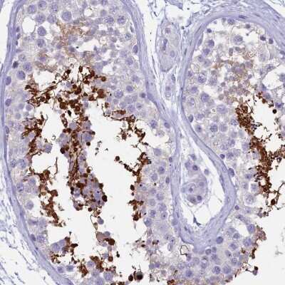 Immunohistochemistry-Paraffin: GAPDH-2 Antibody [NBP2-31925]