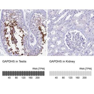Immunohistochemistry-Paraffin: GAPDH-2 Antibody [NBP2-31925]