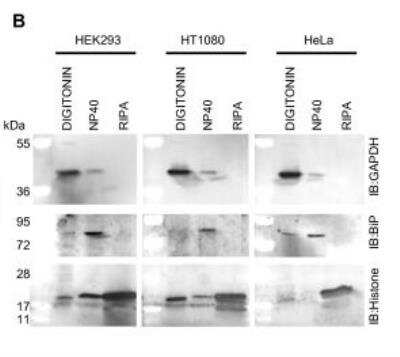 Western Blot Detection of GAPDH in Multiple Cell Lines and Buffer Protocols