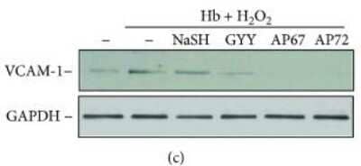 Detection of GAPDH in Western Blot as a Loading Control