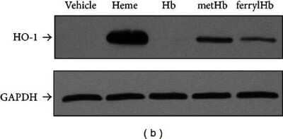 Western Blotting of GAPDH as a Loading Control for Treated HUVECs