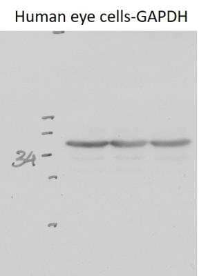 Western Blotting of GAPDH in Human Eye Cell Lysate