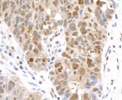 Immunohistochemistry: GAPDH Antibody (BLR103H) [NBP3-14695]