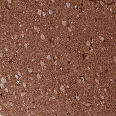 Immunohistochemistry-Paraffin: GAPDH Antibody (CL3265) [NBP2-59025]