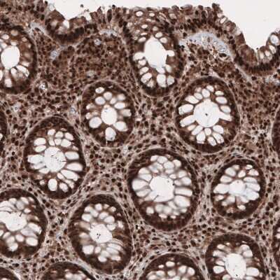 Immunohistochemistry-Paraffin: GAPDH Antibody (CL3265) [NBP2-59025]