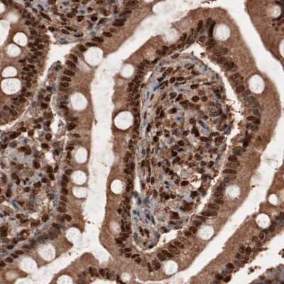 Immunohistochemistry: GAPDH Antibody (CL3266) [NBP2-59779]