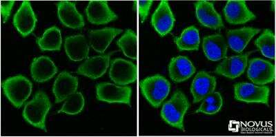 Immunocytochemistry/ Immunofluorescence: GAPDH Antibody [NB300-327]