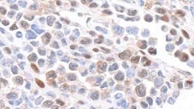 Immunohistochemistry: GAPDH Antibody [NB300-326]