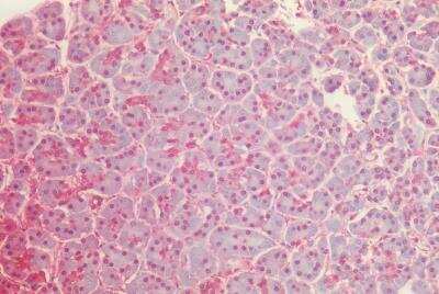 Immunohistochemistry-Paraffin: GAPDH Antibody [NB300-320]