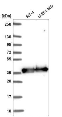 Western Blot: GAPDH Antibody [NBP2-56153]