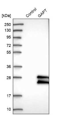 Western Blot: GAPT Antibody [NBP1-86773]