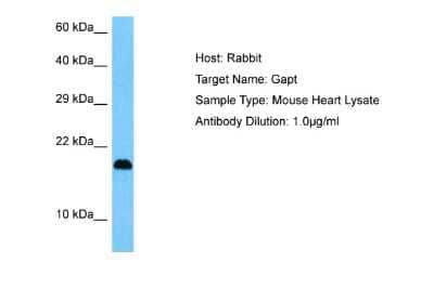 Western Blot: GAPT Antibody [NBP2-82873]