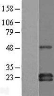 Western Blot: GAPT Overexpression Lysate [NBL1-08489]