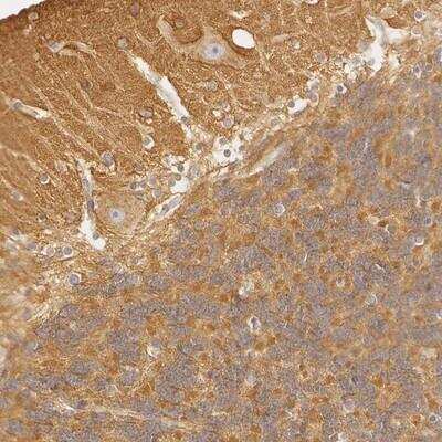 Immunohistochemistry-Paraffin: GARNL1 Antibody [NBP1-87982]