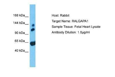 Western Blot: GARNL1 Antibody [NBP2-82874]