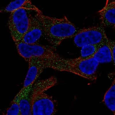 Immunocytochemistry/ Immunofluorescence: GARNL3 Antibody [NBP2-68990]