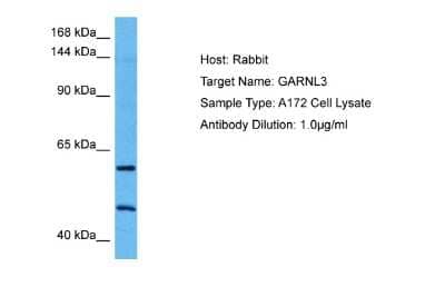 Western Blot: GARNL3 Antibody [NBP2-87364]