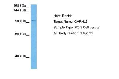 Western Blot: GARNL3 Antibody [NBP2-87489]