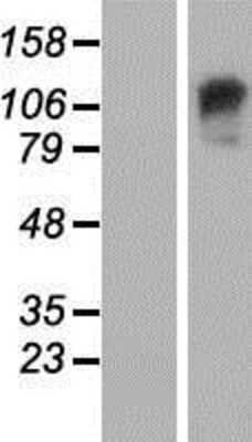 Western Blot: GARNL3 Overexpression Lysate [NBP2-06050]