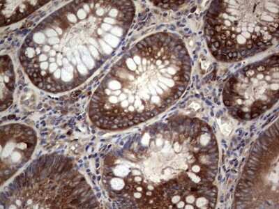Immunohistochemistry: GARS Antibody (OTI4G4) [NBP2-45808]